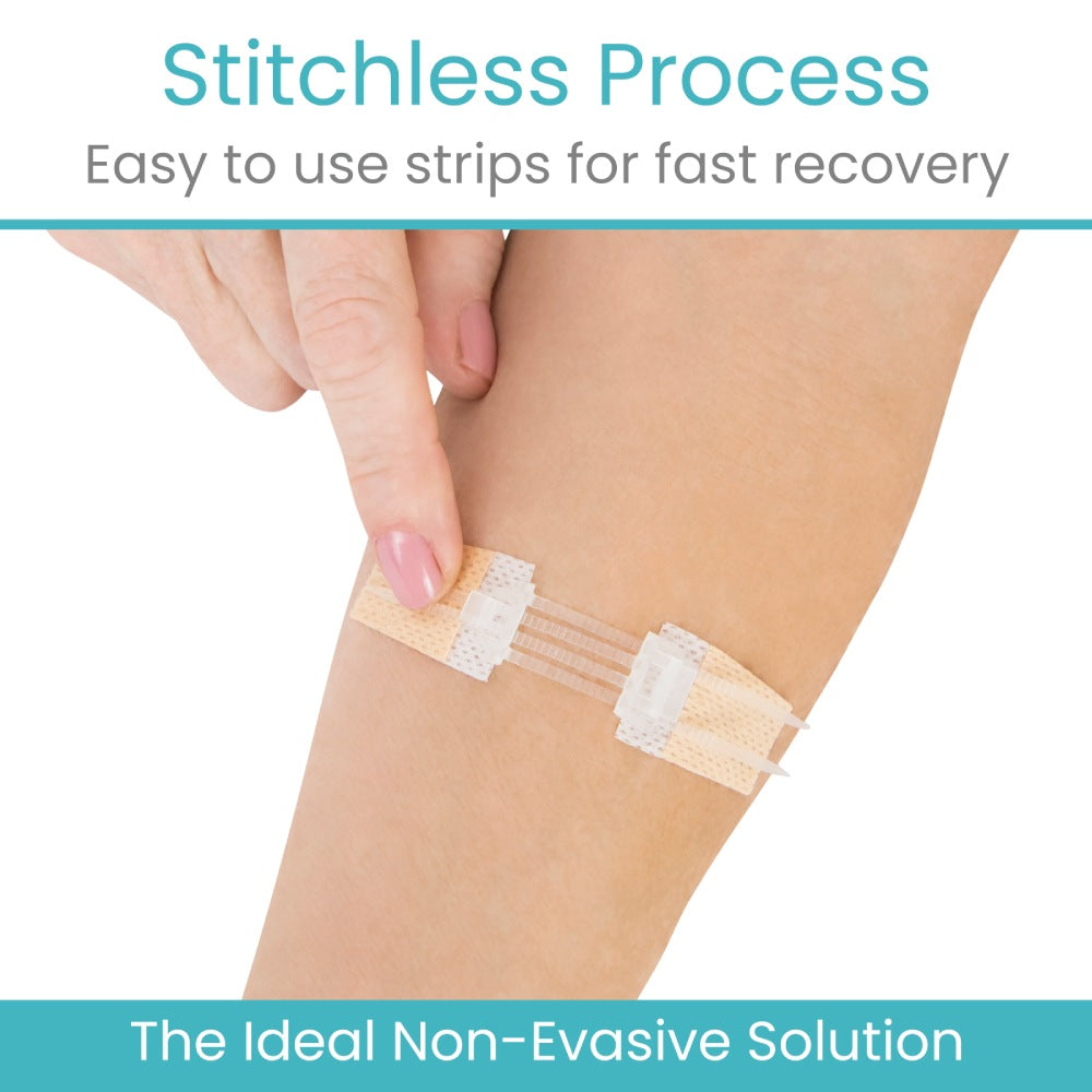 Stitchless Strips